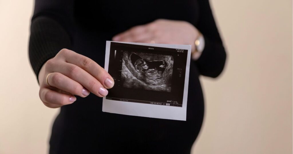 pregnant woman holding ultrasound