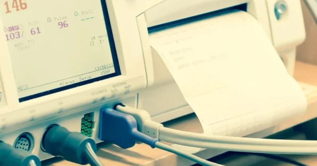 fetal heart monitor for labor at hospital birth