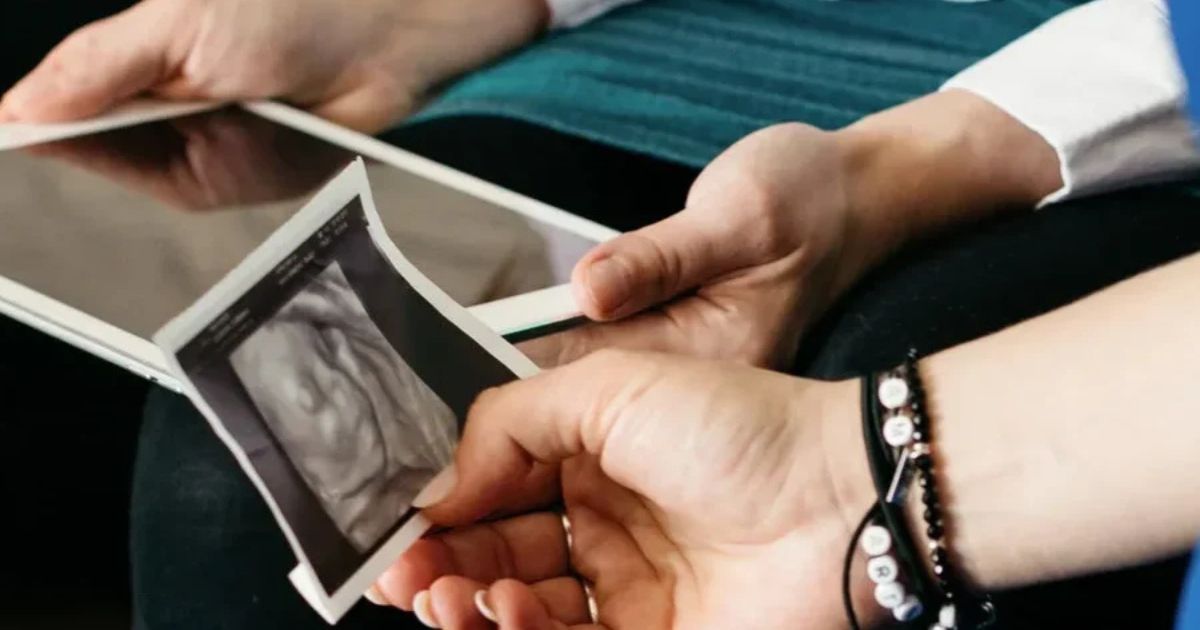 couple looking at ultrasound