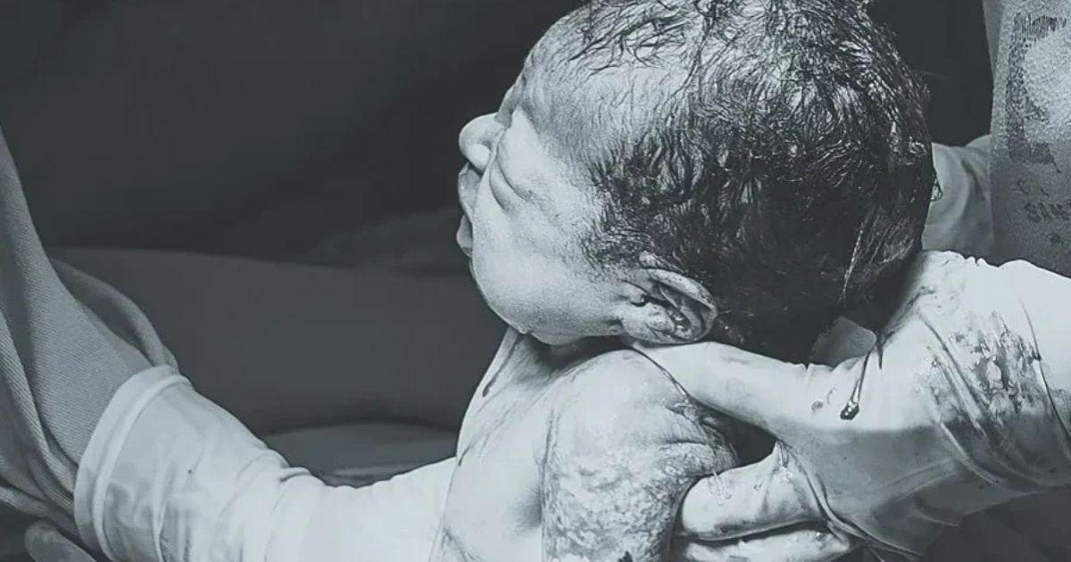 newborn baby at cesarean birth