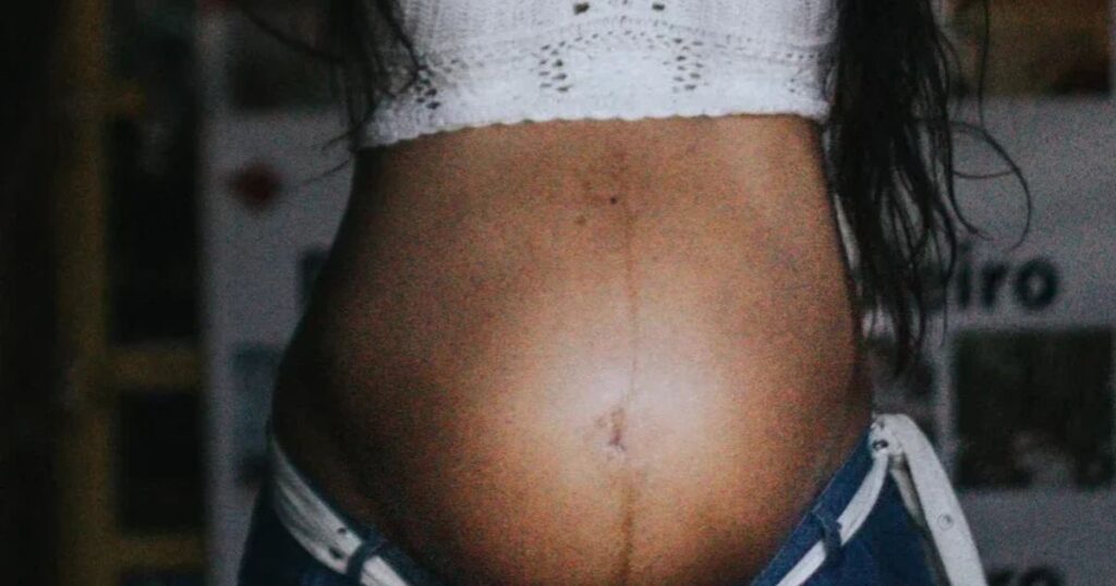 pregnant woman at 41 weeks